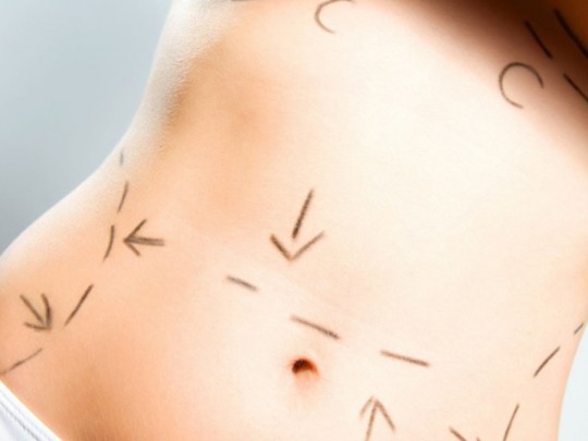thumb-abdominoplastia